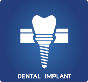 Dental Implant FAQ1 300x280