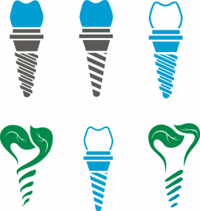 Dental Implants learning the basics 285x300