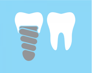 LearnTheLingoImplants 300x240