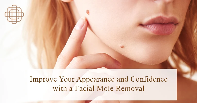 Improve Your Appearance and Confidence with a Facial Mole Removal