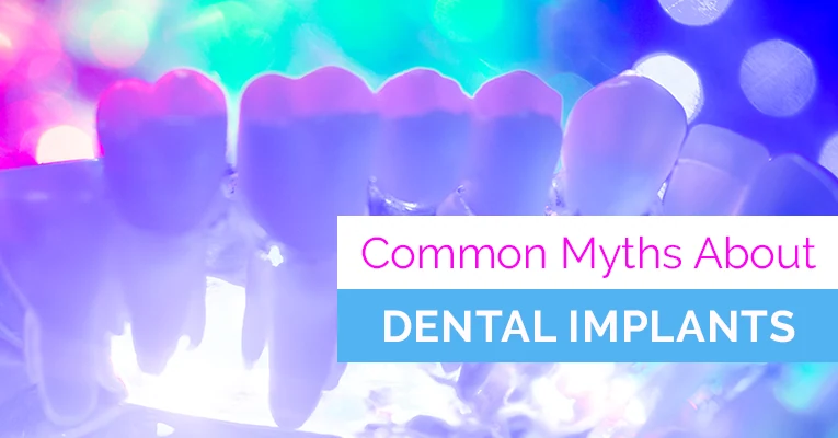 Dental Implant Misconceptions