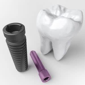 Dental implant d 300x300