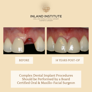 Implants Sept