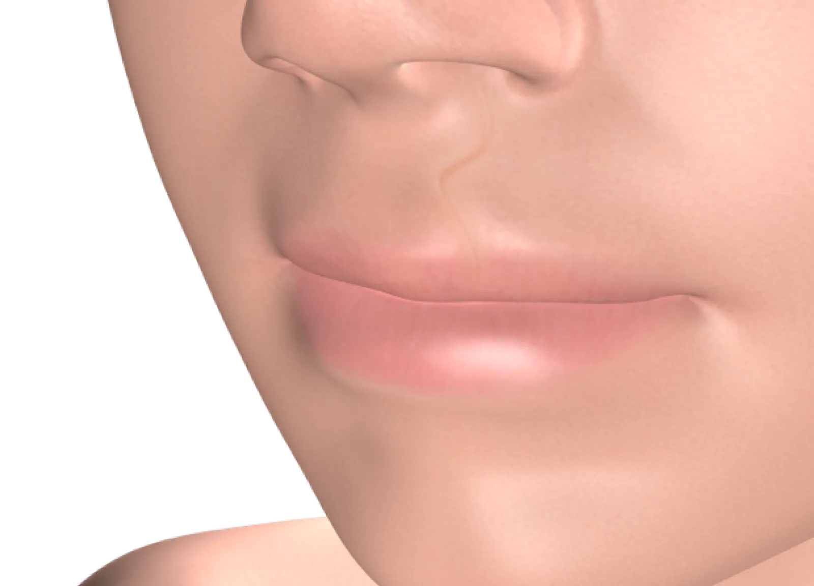 3D illustration of the upper lip for cleft lip and palate repair