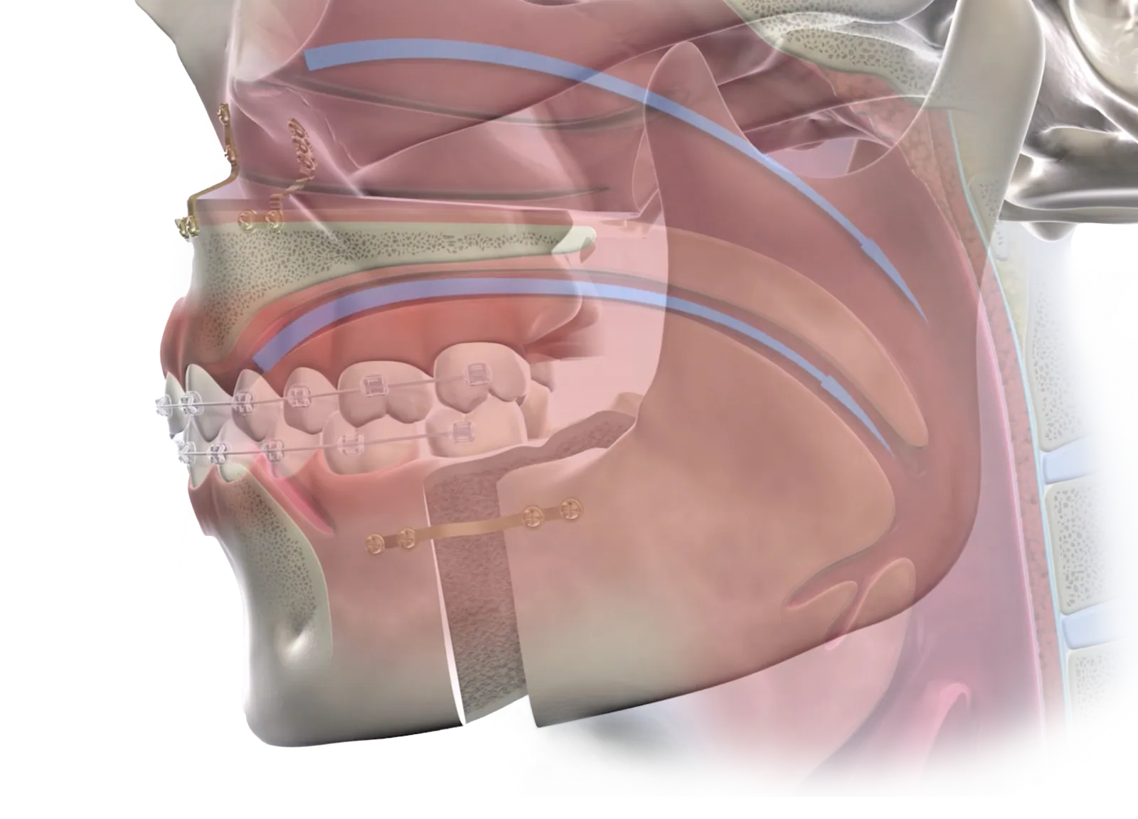 3D illustration of the airway and jaw in profile