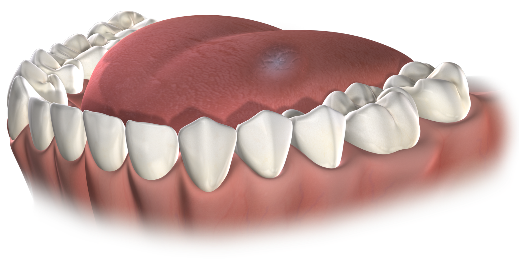 Isolated oral pathology