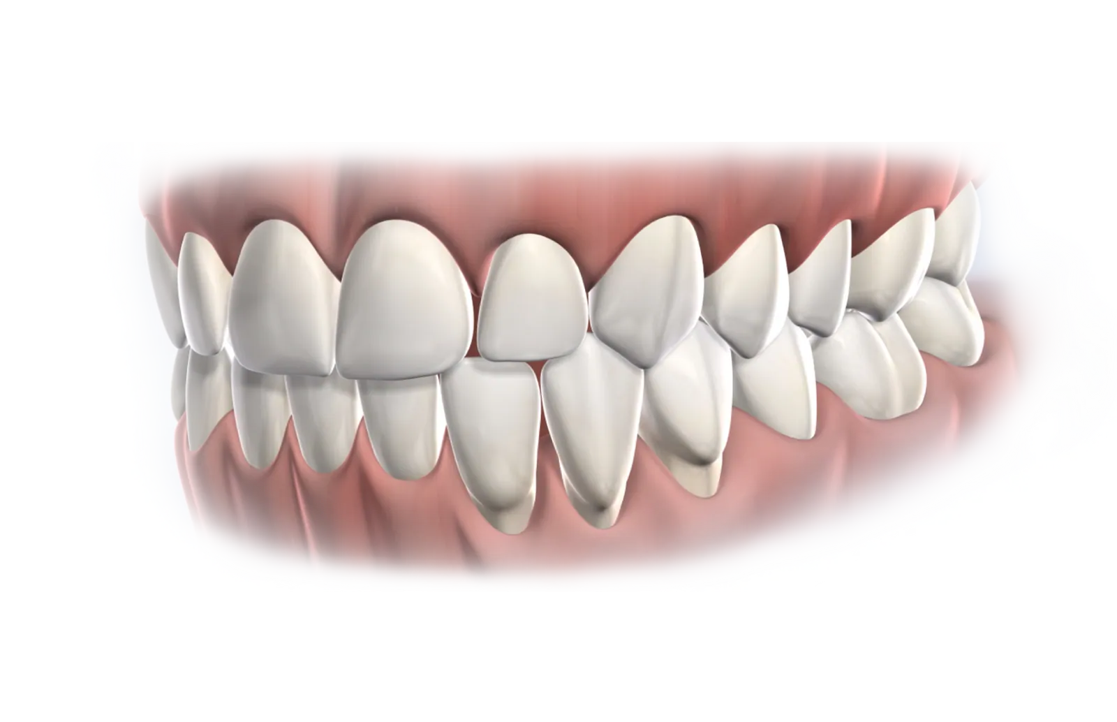 3D illustration of upper and lower teeth and gums
