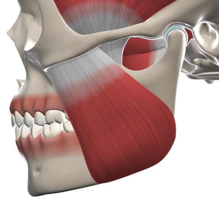 3D illustration of the jaw joint and chewing muscle