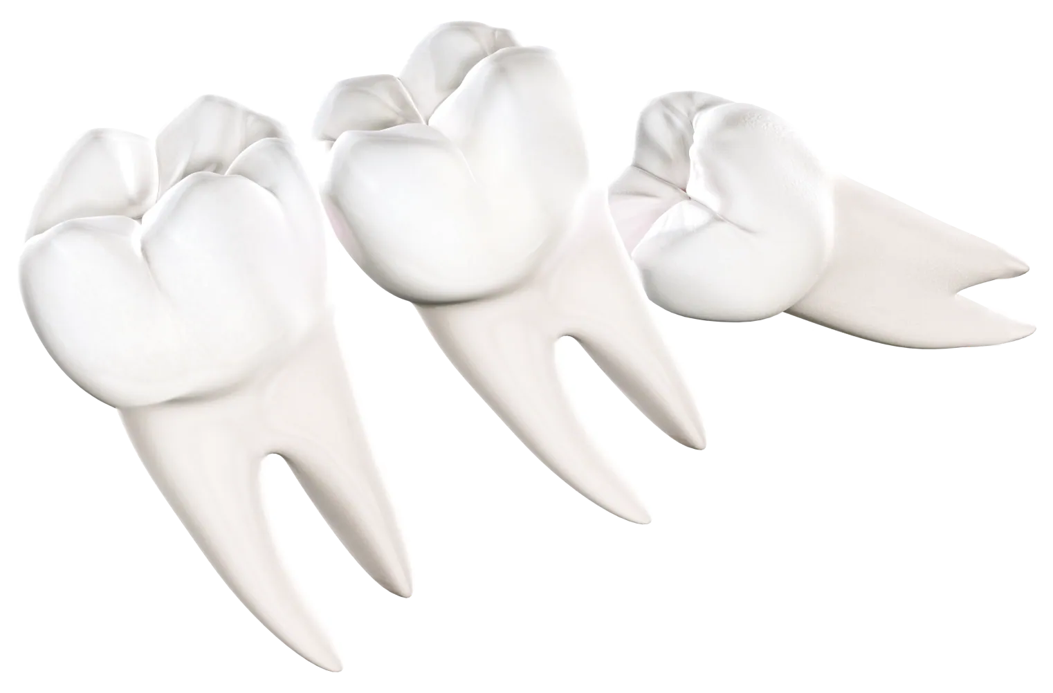 3D illustration of molars and a wisdom tooth