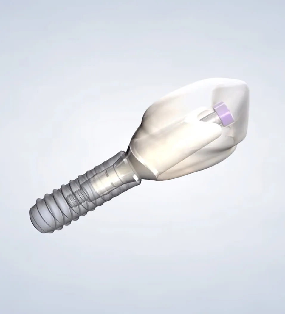 3D illustration of a dental implant with a crown