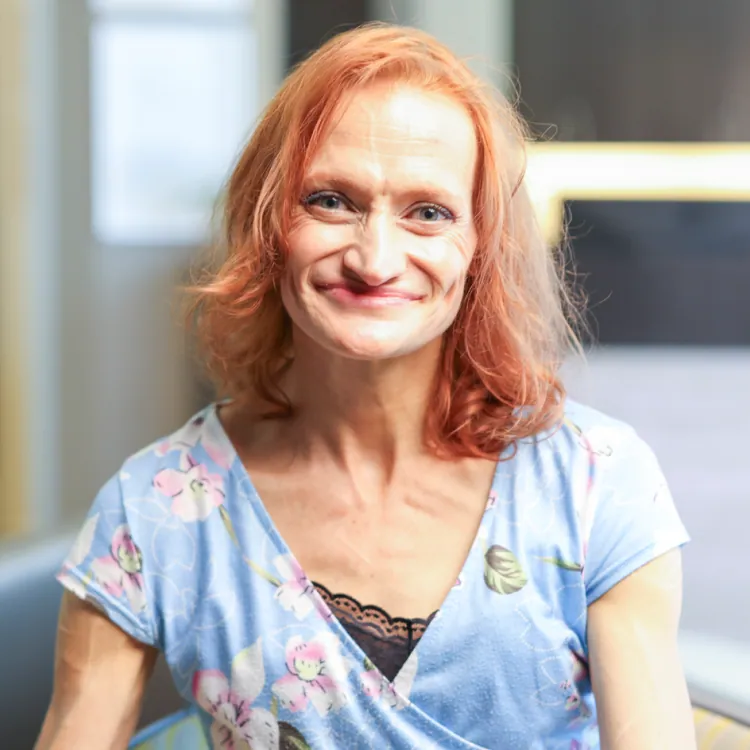 Alyson, osteoplasty patient at Inland Institute