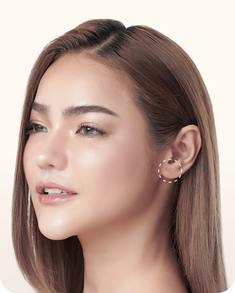Woman showing her ear and earring, earlobe repair