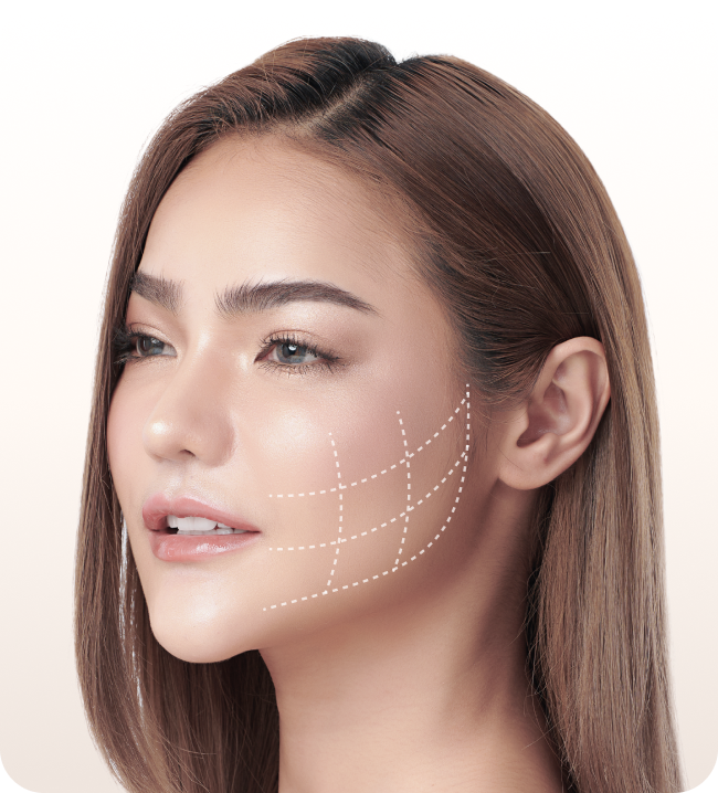 Inland facial liposuction query image