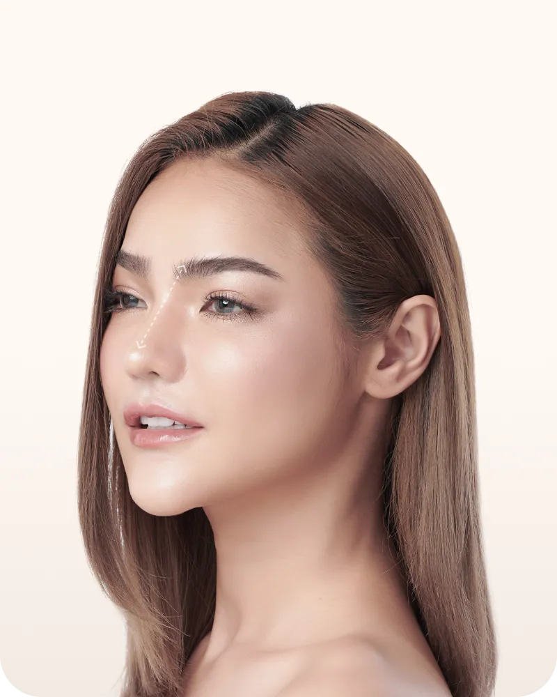 Woman in three-quarter profile, nose reshaping (rhinoplasty)