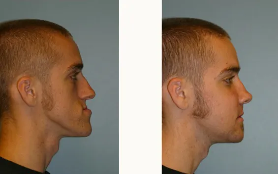 Jaw Surgery & Treatment of Facial Deformities case study