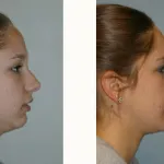 Jaw Surgery & Treatment of Facial Deformities case study