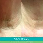 Secret Pro before and after 