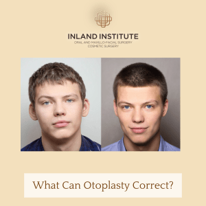 otoplasty before and after 
